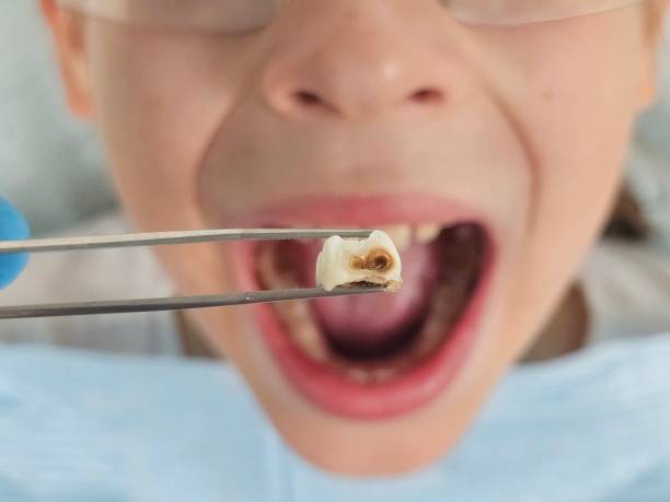 Best Emergency Care for Gum Disease in Krugerville, TX