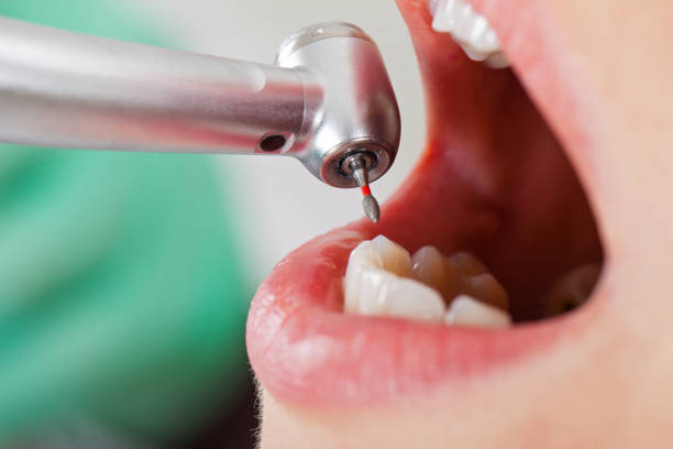 Best Emergency Treatment for Oral Infections in Krugerville, TX